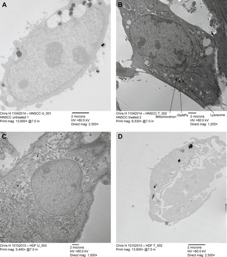 Figure 8 TEM of HNSCC and HDF cell lines.Notes: TEM of HNSCC cell line SCC-9: (A) untreated and unstained and (B) treated and unstained. (B) Bright white dots may be selenium nanoparticles. TEM of HDF cell line CC-2509: (C) untreated and unstained and (D) treated and unstained. The large black dots are impurities on the grid, likely due to excessive handling.Abbreviations: TEM, transmission electron microscopy; HNSCC, head and neck squamous cell carcinoma; HDF, human dermal fibroblast; HV, high vacuum.