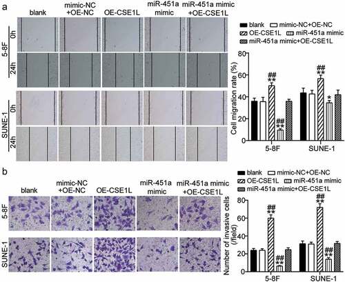 Figure 6. CSE1L overexpression restores the migration and invasion impairment of NPC cells induced miR-451a mimic. (a). In vitro wound healing analysis of NPC cells migration after transfected with pcDNA 3.1-CSE1L (OE), miR-451a mimic, OE-NC + mimic-NC, OE + mimic at 0 and 48 h. (b). In vitro transwell assay was performed to examine the invasion of NPC cells following transfection with OE, miR-451a mimic, OE-NC + mimic-NC, OE + mimic. **P < 0.001 vs. blank; ##P < 0.001 vs. OE + mimic