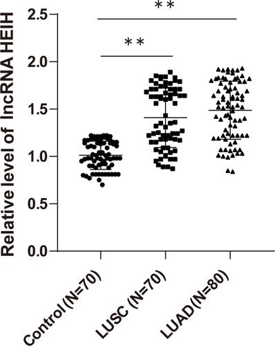 Figure 1 High expression of lncRNA HEIH in peripheral blood of NSCLC patients. The expression of lncRNA HEIH in peripheral blood of NSCLC patients was detected by qRT-PCR. The values were expressed as mean ± standard deviation. One-way ANOVA was used for data comparison among multiple groups. Tukey’s multiple comparisons test was used for post hoc test, **p < 0.01.