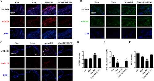 Figure 3 Erzhiwan reduced DNA oxidative damage in experimental depigmentation mice. (A) TUNEL staining was used to observe the level of apoptosis in the skin. The TUNEL-positive cells were marked with white arrows. Scale bar=100 μm. The expression of 8-OHdG (B) and ALOX15 (C) in the skin was detected using an immunofluorescence method. The expression was marked with white arrows. Scale bar=100 μm. (D) The level of plasma 8-OHdG was detected using an ELISA method (n=6). (E) The mRNA expression of Sod2 was detected (n=3). (F) Plasma OGG1 content was detected using an ELISA method (n=6). Data are expressed as mean ± SD, and compared with Con group at *p < 0.05 and **p < 0.01, and compared with Mon group at #p < 0.05 and ##p < 0.01, and compared with Mon+RS group at ^p < 0.05 and ^^p < 0.01.