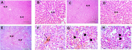 Figure 5 Cisplatin-induced liver injury in liver sections stained with hematoxylin-eosin. Representative microscopic pictures of liver sections showing normal histology of central vein (CV) and well organized radially arranged hepatic cords in cont group (A and B) and GL group (C and D), while disrupted organization of hepatic cords, congestion of CV, centrilobular areas of necrosis, vacuolar and hydropic degeneration in other hepatocytes (E). Higher magnification to show congestion (black arrow), vacuolar degeneration (red arrow) (F) and necrosis (arrowheads) (G and H) in hepatocytes of CP group. H&E, (A, C and E) X: 100 bar 100 and (B, D, and F–H) X: 400 bar 50.