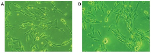 Figure 6 Phase contrast microscopic photographs of MG-63 cells cultured with (A) mesoporous bioactive glass and polyamide composite scaffolds and (B) and polyamide scaffolds for 4 hours.