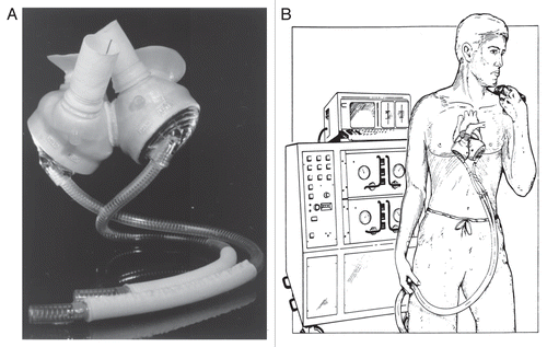 Figure 9 (A) CardioWest total artificial heart. (B) Implanted with Console (Ann Thorac Surg 1999; 68:698–704; Figs. 1 and 2).