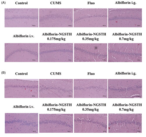 Figure 7. Pathological changes of rat hippocampus. (A) Rat hippocampal CA1 subregion. (B) Rat hippocampal CA3 subregion. Scale bar: 100 µm.