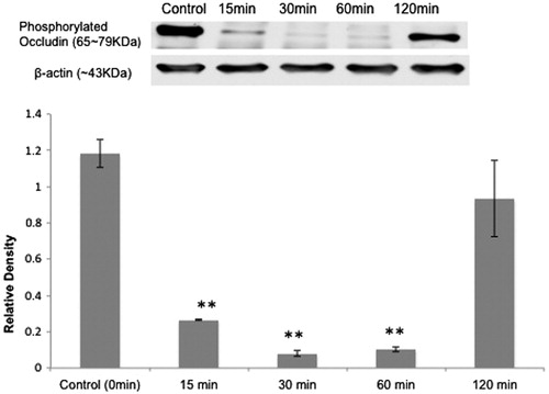Figure 2. Effect of IN PV on OE TJ proteins: (top) western blot analysis showed that IN PV treatment (1.4%) induced a transient decrease in levels of phosphorylated occludin (65–79 kDa) in OE. From left to right, the lanes are control (0 min), 15, 30, 60 and 120 min. (bottom) Relative density ratio (mean ± SE) of phosphorylated occludin/β-actin at different time points (t = 0, 15, 30, 60 and 120 min). **Significantly different from t = 0 min at p < 0.05.
