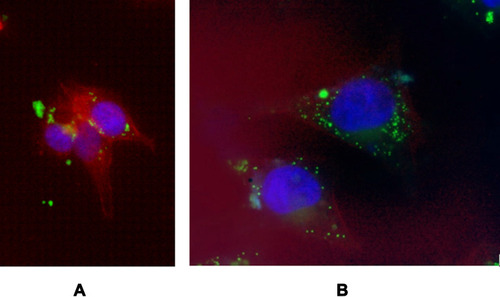 Figure 12 Cellular uptake of coumarin-6 nanoparticles (C6-PLGA NPs) by A375 cell line as seen under fluorescence microscope after immunofluorescent staining of the actin cytoskeleton and the nucleus of the cells using TRITC-conjugated phalloidin (red) and DAPI (blue) respectively; (A) 40X, (B) 100X magnifications.