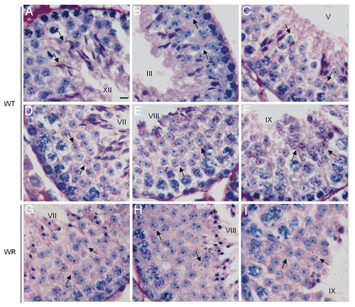 Figure 4 PAS-hematoxylin staining of wild-type (A–F) and wr (G–I) mouse testis to detect different phases of acrosomogenesis. Representative cross-sections of seminiferous tubuli are shown. Stages of the seminiferous epithelial cycle are marked with Roman numerals. PAS-positive (pink) proacrosomal granules, acrosomal caps and acrosomes are indicated by arrows. In contrast to the wild type (D–F), no evident acrosomal caps and acrosomes were detected, independently from the acrosomogenetic step, in the wr testis (G–I). PAS-staining resulted only in punctuate spots (arrows) scattered into the wr spermatid cytoplasm. Scale bar, 10 µm.