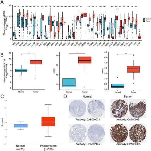 Figure 1 Expression patterns of KRT19 in tumors and normal tissues. (A) KRT19 mRNA levels in distinct tumors and normal controls using TCGA and GTEx databases. (B) KRT19 expression in OV and normal ovarian tissues based on TCGA, GTEx and GEO databases. (C) KRT19 protein levels in OV and normal ovarian tissues analyzed by the UALCAN database. (D) Representative results of immunohistochemically stained KRT19 proteins in OV and normal ovarian tissues from Human Protein Atlas. ns, no significant difference; *p < 0.05; **p < 0.01; ***p < 0.001.