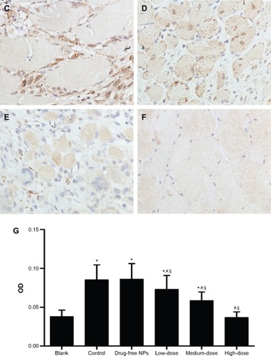 Figure 8 TGF-β1 expression in the peritoneal tissues after 7 days of treatment, detected by immunohistochemistry.Notes: High, medium and low dose groups were administered with 10, 5 and 2.5 mg/kg Tan IIA-NPs via tail vein injection, respectively. Representative images (at 200× magnification) of peritoneal tissues that were stained immunohistochemically with anti-TGF-β1 antibody. (A) Blank control group. (B) Control group. (C) Drug-free group. (D) Low-dose group. (E) Medium-dose group. (F) High-dose group. (G) Quantitative assay of OD from five randomly selected fields. The results are presented as mean ± standard deviation (n=5). *P<0.05 compared with blank; #P<0.05 compared with control; §P<0.05 compared with drug-free NPs.Abbreviations: NPs, nanoparticles; OD, optic density; TGF-β1, transforming growth factor-β1.