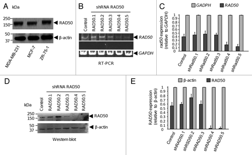 Figure 2. RAD50 expression and shRNA-mediated RAD50 silencing in breast cancer cells. (A) Western blot assays for RAD50 expression in MCF-7, MDA-MB-231, and ZR-75-1 breast cancer cells. β-actin was used as internal loading control. (B) RT-PCR assays for RAD50 knock-down using three shRNAs in MCF-7 cells. GAPDH gene was amplified as internal control. (C) Densitometric analysis of bands from B. (D) Western blot assays for RAD50 protein in MCF-7 cells. Total proteins isolated from shRAD50-transfected cells were resolved by SDS-PAGE, transferred to PVDF membrane, and blotted with anti-RAD50 antibodies. β-actin protein was detected as internal loading control. (E) Densitometric quantification of immunodetected bands depicted in (D). In both RT-PCR and western blot assays, pixels corresponding to GAPDH mRNA and β-actin protein expression, respectively, were taken as 100% and used to normalize RAD50 expression. Representative data are shown and densitometric data represent the mean of three independent assays ± SD.