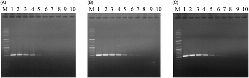 Figure 4. Sensitivity of the TDP-F and TDP-R primer set for pathogen DNA extracts. DNA bands amplified by PCR with the TDP-F and TDP-R primer set from 10-fold serial dilutions of gDNA from 5 ng to 5 ag of (A) T. harzianum (KACC40558); (B) T. pleurotum (KACC44537); or (C) T. pleuroticola (CAF-TP3). M, 100-bp plus DNA ladder (Bioneer, Daejeon, Korea); lane 1, 5 ng; lane 2, 500 pg; lane 3, 50 pg; lane 4; 5 pg; lane 5, 500 fg; lane 6, 50 fg; lane 7, 5 fg; lane 8, 500 ag; lane 9, 50 ag; and lane 10, 5 ag.