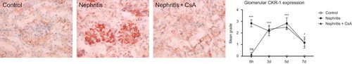 Figure 7.  CXCR1 expression in glomeruli of rat kidneys during the experimental period and histological appearances of kidneys in control (grade 0, at sixth hour), nephritis (grade 4, at sixth hour), and nephritis + CsA (grade 0, at sixth hour) groups. Values are expressed as mean ± SEM. n = 6 at each time point for each group. Notes: *Denotes p < 0.05 against control group, ***denotes p < 0.001 against control group. ns, not significant against control group. CsA, cyclosporine A.