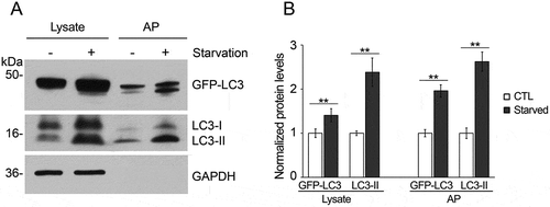 Figure 4. Increase in autophagosome markers under starvation conditions in immunoisolated autophagosomes. (a) Tissue lysate and immunoisolated autophagosomes from the liver of starved (24 h) and non-starved GFP-LC3 mice were compared by western blotting probed for LC3 and GAPDH. (b) Quantification of the band density, as shown in the histogram, shows the increased levels of autophagosome-related proteins after starvation, consistent with the increased level of autophagy. N = 4 mice; ** P < 0.01.