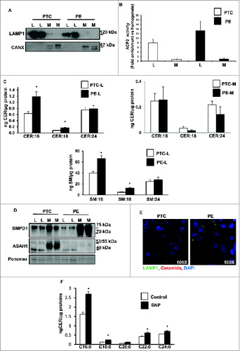 Figure 5. Ceramide accumulates in lysosomal fractions in preeclampsia. (A and B) PE and PTC placental tissue were subjected to subcellular fractionation. Lysosomal (L) fractions were enriched in LAMP1 (A) and ACP2/acid phosphatase activity (B) whereas microsomal (M) fractions contained CANX (A). (C upper panel) CER levels in lysosomal (L) and microsomal (M) subfractions isolated from PE and PTC placentae (PE, n = 5; PTC, n = 5 *P<0.05). (C lower panel) SM content in L subfractions from PE and PTC placentae. (D) SMPD1 and ASAH1 protein expression in L and M subfractions from PE and PTC placentae. (E) Immunofluorescence analysis of CER and LAMP1 of placental sections from PTC and PE to visualize CER compartmentalization to lysosomes. (F) CER levels in L subfractions from villous explants treated with SNP or control vehicle. CANX, calnexin.