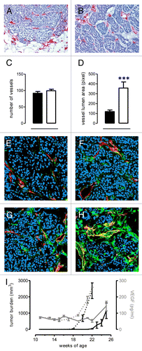 Figure 6. C3 deficiency does not modify absolute blood vessel number but changes vessel architecture. (A–B) Immunohistochemical staining of cryosections for endothelial cell markers (CD31 and CD105, red) to visualize blood vessels in mouse tumors of equal volume developed in neuT (A) and neuT-C3−/− (B) mice. (C–D) Quantification of the number (C) and lumen area (D) of vessels in neuT (black bar) and neuT-C3−/− (white bar) carcinoma. Results are represented as means ± SEM from 7 X100 microscopic fields of 10 tumors. (E–H) Confocal microscopy analysis of samples stained with anti-CD31 antibodies (red) and anti-Ng2 antibody (E and G, green) or anti-SMA antibodies (F and H, green) in neuT (E and F) or neuT-C3−/− (G and H) tumors. (I) Circulating levels of vascular endothelial growth factor in neuT (n = 5, continuous gray line) and neuT-C3−/− (n = 6, dotted gray line) mice were evaluated by ELISA and plotted together with mice tumor burden (continuous black line and dotted black line for neuT and neuT-C3−/− mice, respectively). A statistically significant (***P = 0.0002 between week 22 and 25 for neuT mice and ***P = 0.0003 between week 19 and 21 for neuT-C3−/− mice) increase in serum VEGF along with tumor progression was observed in both neuT and neuT-C3−/− mice.