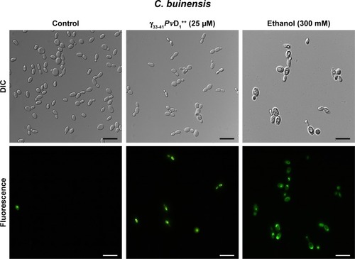 Figure 5 Images of membrane permeabilization assay of Candida buinensis cells after treatment with γ33-41PνD1++ (25 µM) for 24 hours. Control cells were treated only with the Sytox green probe and positive control cells were treated with 300 mM ethanol. Bars =20 µm.Abbreviation: DIC, differential interference contrast.