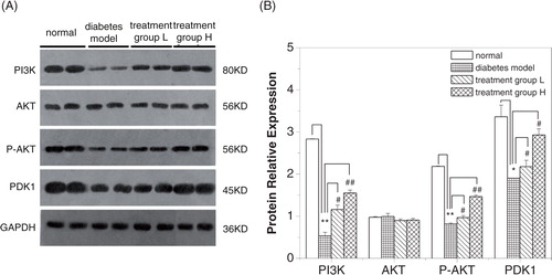 Fig. 5 Effect of GD on AKT, P-AKT, PI3K, and PDK-1 protein expressions in pancreatic tissues of diabetic mice. (A) Western blot analysis of AKT, P-AKT, PI3K, and PDK-1 protein expressions. (B) Quantitative analysis of AKT, P-AKT, PI3K and PDK-1 protein expressions. Treatment group L: 1.2% GD-treated diabetic group; Treatment group H: 4.8% GD-treated diabetic group. Data are given by mean±SD. *p<0.05 and **p<0.01, respectively, versus the normal group; # p<0.05 and ## p<0.01, respectively, versus the diabetic model group.