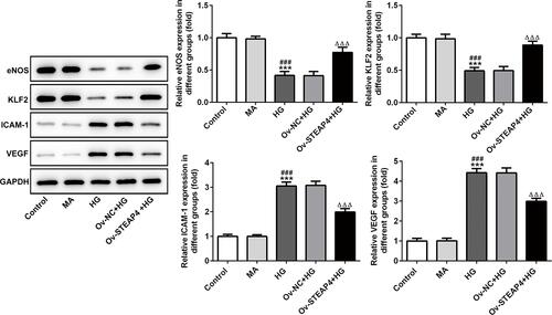 Figure 4 Overexpression of STEAP4 ameliorated HG-induced endothelial dysfunction. The expression of VEGF, KLF2, eNOS and ICAM-1 was detected by Western blot. n=3, ***p<0.001 vs Control; ###p<0.001 vs MA; ΔΔΔp<0.001 vs Ov-NC+HG.Abbreviations: Ov-NC, overexpression-NC; Ov-STEAP4, overexpression-STEAP4; HG, high glucose.