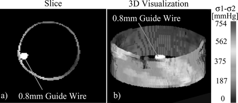 Figure 6 (a) Slice showing the cross-section of the stress field and guide wire reconstructed from sinograms using the Maximum-Likelihood Expectation-Maximization method. (b) Three-dimensional visualization of the stress within the blood vessel and of the guide wire.