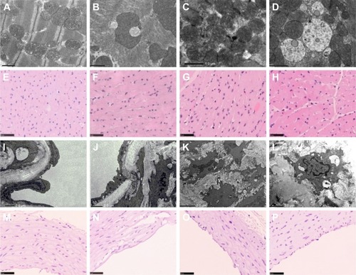 Figure 2 The TEM image of heart in Sprague Dawley rats triggered by SiNPs, Pb, and co-exposure: (A) control group, (B) SiNPs group, (C) Pb group, (D) SiNPs + Pb group. The H&E image of heart in Sprague Dawley rats triggered by SiNPs, Pb, and co-exposure: (E) control group, (F) SiNPs group, (G) Pb group, (H) SiNPs + Pb group. The TEM image of aortic arch in Sprague Dawley rats triggered by SiNPs, Pb, and co-exposure: (I) control group, (J) SiNPs group, (K) Pb group, (L) SiNPs + Pb group. The H&E image of aortic arch in Sprague Dawley rats triggered by SiNPs, Pb, and co-exposure: (M) control group, (N) SiNPs group, (O) Pb group, (P) SiNPs + Pb group.Abbreviations: SiNPs, silica nanoparticles; Pb, lead acetate; TEM, transmission electron microscopy.