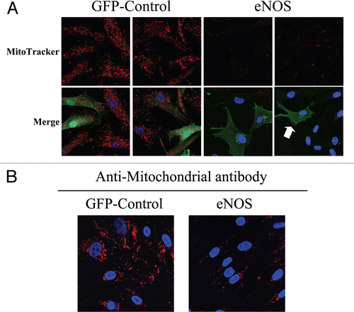 Figure 13 Nitric oxide production induces mitochondrial dysfunction in fibroblasts. (A) eNOS recombinant overexpression decreases mitochondrial activity and phenocopies loss of Cav-1. hTERT-fibroblasts transiently expressing eNOS or the GFP-control were incubated with MitoTracker (red). eNOS (green) was visualized using an eNOS antibody while GFP-controls (green) were visualized using autofluorescence. DAPI was used to stain nuclei (blue). Note that mitochondrial activity is undetectable in eNOS expressing cells, and even in eNoS negative cells that are adjacent to eNOS positive cells. This is consistent with the idea that NO is a diffusible metabolite which mediates a “field effect” (see the white arrow, pointing at a single eNOS positive cell, surrounded by 8 eNOS negative fibroblasts). GFP-control cells display high levels of mitochondrial staining, as expected. Importantly, images were acquired using identical exposure settings. Original magnification, 63x. (B) eNOS recombinant overexpression decreases mitochondrial mass. hTERT-fibroblasts stably overexpressing eNoS also show dramatic reductions in mitochondrial mass, as compared with control fibroblasts stably expressing GFP. Cells were fixed and immunostained with an anti-intact mitochondrial membrane antibody (red). DAPI was used to stain nuclei (blue). Original magnification, 63x.