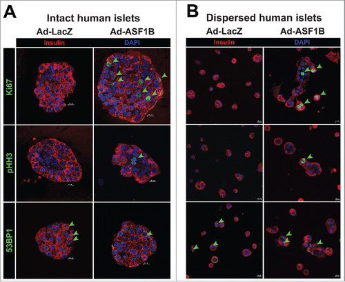 Figure 4. ASF1B overexpression induces mitotic progression, but not DNA damage, in intact and dispersed human islets. Representative confocal images (60X) of (A) intact human islets (N = 20) and (B) dispersed human islet cells treated with Ad-LacZ or Ad-ASF1B, and labeled with the proliferation markers Ki67 and phospho-histone H3 (pHH3 S10) that mark cells through mitotic progression, and with the DNA damage marker, 53BP1 to mark nuclei undergoing DNA damage response (48 h). β-cells are identified by insulin (red), nuclei by DAPI (blue).