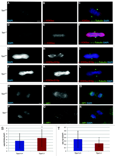 Figure 6. Acetylation of H3K9 is increased in mitotic, Trps1-/- cells. (A–F and M) Immunofluorescent labeling of primary chondrocyte from wild-type (A–C) and Trps1-/- (D–F) mice using α-H3K9ac and α-y-Tubulin antibodies and DAPI counterstaining revealed increased H3K9 acetylation in metaphases of Trps1-/- mutants (D–F). (M) Quantification of the mean fluorescence intensity of H3K9 acetylation in relation to DAPI (n =5; 100 mitoses per animal; p* = 0.000003). (G–L) Immunofluorescent staining of wild-type (G–I) and Trps1-/- chondrocytes (J–L) with an α-H3K9acS10p antibody revealed an increased level of acetylated pH3 in mitotic, Trps1-/- cells. Scale bar: 10 µm. (M–R) Immunofluorescent labeling with an α-HP1β antibody as marker for pericentric heterochromatin showed reduced staining in Trps1-/- cells (P–R) compared with wild-type chondrocytes (M–O). (A) Quantification of the mean fluorescence intensity of H3K9 acetylation in mitotic cells in relation to DAPI (n =5; 100 mitoses per animal; p* = 0.000003). (B) Quantification of the mean fluorescence intensity of Hβ1 staining in mitotic cells in relation to DAPI (n =4; 30 mitoses per animal; p* = 0.00004)