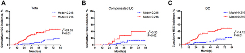 Figure 3 Kaplan–Meier analysis of Model (Age_GGT_PLT) in patients with liver cirrhosis. (A) total population, (B) patients with compensated LC, (C) patients with DC.