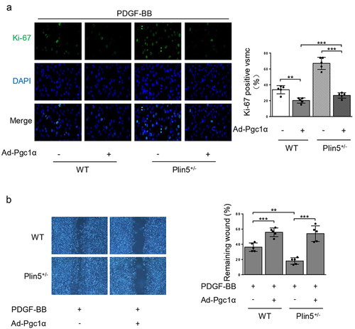 Figure 6. Plin5 knockdown causes increased VSMC proliferation and migration induced by PDGF-BB in a Pgc1α-dependent manner. VSMC isolated from WT or Plin5± mice was transfected with Ad-Con or Ad-Pgc1α. VSMC was next incubated with PDGF-BB (30 ng/mL) for 48 h. (a) VSMC was stained with Ki-67 (green) and DAPI (blue). Representative images (left) and corresponding quantification of Ki-67 positive VSMC (right) were shown (n = 5). Magnification 400 × . (b) Migration of VSMC was measured via wound healing assay. Representative images (left) and corresponding quantification of healing rates (right) were shown (n = 5). Magnification 100 × . **P < 0.01 and ***P < 0.001 denote statistical comparison between the two marked groups, respectively. Data are shown as mean ± S.D.
