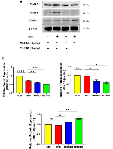 Figure 8 MLT inhibited HFD-mediated hepatic fibrosis through MMP regulation. (A) Western blot analysis of MMP2, MMP9, and TIMP 1 protein, (B) The bar graph showed the quantification of MMP 2/β actin, MMP 9/β actin, and TIMP 1/β actin, respectively. The values indicate the mean ± SEM (n=3), *p < 0.05, **P< 0.01, ***P<0.001, ****P<0.0001.