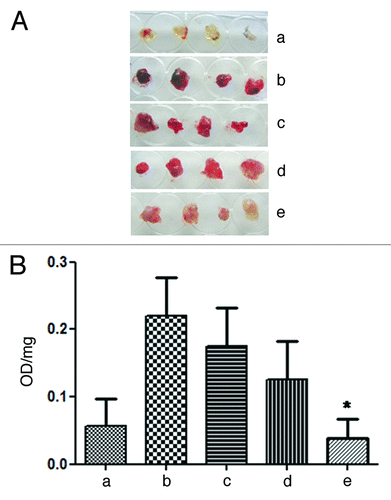Figure 8. ZOL inhibits in vivo angiogenesis evaluated by matrigel plug assay. In vivo vessel formation was assessed after the injection of C57BL/6 mice with matrigel plugs containing heparin only (negative control) (a), containing heparin, VEGF and TNFα (positive control) (b), containing CG5 cells untreated (c) or previously treated with Denosumab at 100 μM (d) or ZOL at 100 μM (e) for 24 h in serum-free medium. After 5 d, animals were sacrificed and neovascularisation was evaluated by macroscopic analysis and by the measurement of Hb content of matrigel plugs. The macroscopic appearance of representative matrigel plugs from each experimental group is shown (A). Histograms represent the mean value (n = 10; data from two independent experiments) of the Hb content, expressed as absorbance (OD)/100 mg of matrigel plug. Bars: +SD values (B). Denosumab vs untreated: p = 0.08; ZOL vs. untreated p = 0.0008 (*).