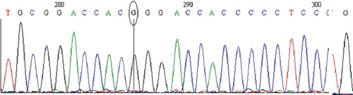 Figure 2. Chromatogram of DNA sequencing for the MT1A (C>G) polymorphism. Major homozygous individual with a C/C genotype. Note: Reverse primer was used. Visualization with BioEdit (v. 7.2.5) software.