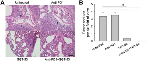 Figure 6. SGT-53 substantially reduces lung metastases of 4T1 tumors. Lung tissues were harvested from tumor-bearing BALB/c mice treated as shown in Figure 3A. (A) Representative images of H&E stain of lung. T, tumor. Scale bar, 100 µm. (B) Metastatic lung nodules were microscopically counted per 4× field of view and plotted. At least five fields of view from three tissue sections were counted and averaged. Data are shown as mean ± SEM. *p < 0.001, 1-way ANOVA with Bonferroni t-test.