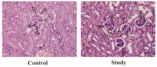 Figure 6. The renal pathological changes in the experimental groups. (a) capsular space; (b) endothelial cells; (c) lymphocytes; (d) capillary; (e) mesangial cells. In the control group, the numbers of glomerular mesangial and endothelial cells were increased compared to the study group, and glomerular capillary was dilated and congested with mild lymphocytic infiltration, which further narrowed the capsular space. After Blimp-1 expression was inhibited by Blimp-1 siRNA (study group), the glomerular pathological changes in the study group were mitigated. The numbers of mesangial and endothelial cells and the capsular space tended to be normal, and there were no significant inflammatory changes found in glomerulus.