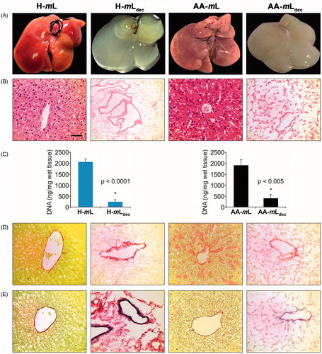 Figure 1. Characterization of liver tissue scaffolds. (A) Macroscopic appearance before and after the decellularization procedure of native healthy (H-mL), amyloidotic (AA-mL), decellularized healthy (H-mLdec) and amyloidotic (AA-mLdec). (B) Sections stained with H&E. (C) DNA quantification of mouse livers to show reduction of DNA after decellularization confirming removal of cells. (D) Sections stained with SR. (E) Elastin Van Gieson staining of mouse livers sections shows preservation of collagen and elastin after decellularization. Scale bar for 40× magnification: 50 µm.