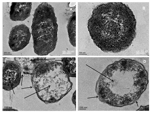 Figure 10 Transmission electron microscopy images of K. pneumoniae showing structural alteration after treatment with biosynthesized AgNPs at 32 µg/mL for 4 h (C, D), and untreated control (A, B). Arrows indicate the cellular damage in K. pneumoniae cells treated with AgNPs.