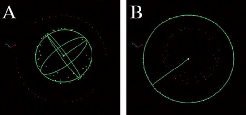 Figure 3. Calculation using 3DReshaper, by the method of least squares, of the center and diameter of a spherical femoral head (panel A) and the center and diameter of a circular rim of a metal-backed acetabular component (panel B).