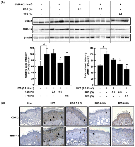Figure 4. Effect of RBS on UVB-irradiated COX-2 and MMP-13 expression in SKH-1 hairless mouse skin. (A) RBS inhibits UVB-irradiated COX-2 and MMP-13 expression in SKH-1 hairless mice. (B) Immunohistochemical staining for COX-2 and MMP-13 expression in the skin (magnification X200). Skin samples were stained for COX-2 and MMP-13 expression with a specific polyclonal antibody and assessed by microscopy. Results are shown as means ± S.D. (n = 8). The hash symbol (#) indicates a significant difference (p < 0.05) between the control group and the UVB-irradiated group. Asterisks (* and **) indicate a significant difference of p < 0.05 or p < 0.01 between the RBS diet group and UVB-irradiated group.