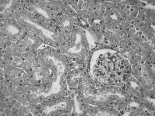 Figure 3. Cytoplasmic vacuolization of tubules in the renal cortex of rats submitted to hemorrhage of 30% of volemia.
