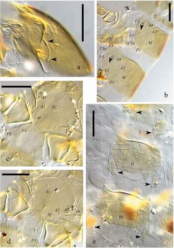 Figure 2. Acerentulus iranicus sp. nov. (interference contrast microscope). (a) Maxillary gland (side view); (b) Thorax (dorso-lateral view): arrows indicate sl pores; (c) Mesosternum; (d) Metasternum; (e) Abdominal sternites I–III: arrows indicate abdominal appendages. Scale bars 50 μm. Figures (a, e): holotype. Figures (b–d): paratype.