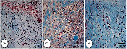 Figure 2. Histological photomicrograph from wound area on day 3. (A) Control group, (B) 5% C. verum-treated and (C) 10% C. verum-treated groups. Note well-formed granulation tissue, high collagen biosynthesis as well as condense collagen condensation in C. verum-treated groups, (Masson-Trichrome staining, 600×).