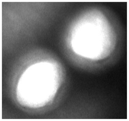 Figure 2 Transmission electron micrograph of a docetaxel-loaded nanoparticle.