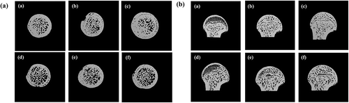 Figure 4. Micro-CT images of proximal trabecular femur bone.Each capital letter represents – (a): transversal tomogram; (b): sagittal tomogram. Each small letter in parentheses represents – (a): sham-con; (b): sham-UV(X); (c): sham-UV(O); (d): OVX-con; (e): OVX-UV(X); (f): OVX-UV(O) groups.