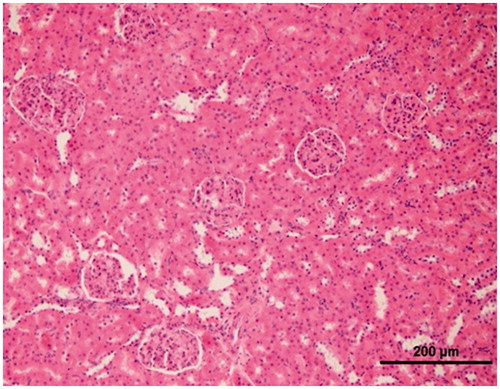 Figure 7. The histopathological evaluation of the renal tissue of SG group.