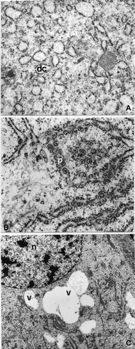 Figure 4. A. strepens stage 6: epithelial cells. A, The RER is made up of piled dilated cisterns (dc; 39,000×). B, Polyribosomes (p) adherent to the RER (6600×). C, Secretory vesicles (v) containing an electron transparent material near the nucleus (n; 10,000×).