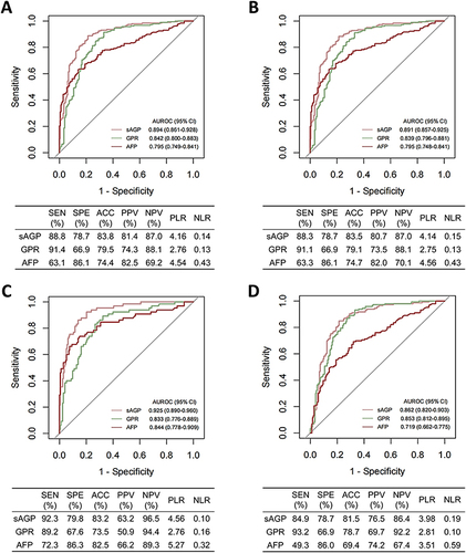 Figure 4 Receiver operating characteristic curves and diagnostic validity metrics of sAGP in the diagnosis of aHCC subgroups. (A) Early BCLC stage (0/A) aHCC vs aBFHL; (B) Early TNM stage (I) aHCC vs aBFHL; (C) Small aHCC (tumor diameter < 3 cm) vs aBFHL; (D) AFP-negative aHCC (AFP < 20 ng/mL) vs aBFHL.