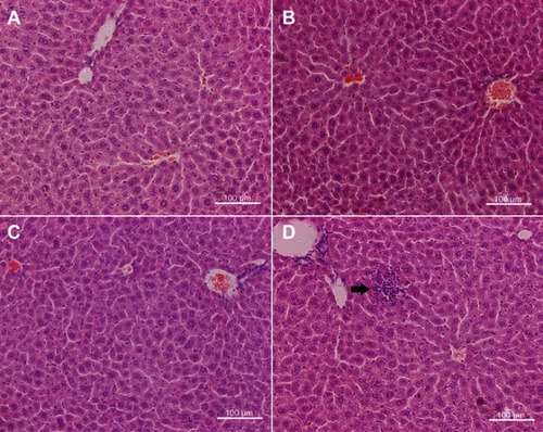 Figure 4 Hematoxylin and eosin-stained images of the liver from control (A) and mice injected ZrO2 at the dose 100 mg/kg (B), 350 mg/kg (C) and 500 mg/kg (D). Black arrow indicates lymphocytic infiltration. (Bar is 100 μm).