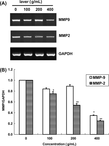 Fig. 6. Expression of MMP-2/-9 mRNA in SK-Hep1 cells after treatment with laver extract for 24 h, as measured by RT-PCR.Note: Values marked * and ** indicate significant differences from control (p < 0.05).