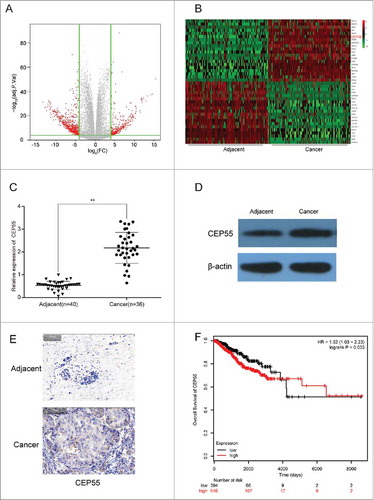 CEP55 was up-regulated in breast cancer tissues and cells. (A) The volcano plot showed the relationship between fold change and significance of mRNAs expression. (B) The heat map showed the top 20 high-expressed and 20 low-expressed mRNAs in breast cancer. (C) QRT-PCR assay was used to detect the mRNA expression level of CEP55. The results showed that the mRNA expression level of CEP55 in cancer tissues was significantly increased.**P < 0.01, compared with adjacent tissues, number of adjacent tissue = 40, number of cancer tissue = 36. (D-E) Western blot and immunohistochemistry assays were used to detect the protein expression level of CEP55. The results revealed that CEP55 protein expression level was up-regulated in breast cancer tissues and cells. (F) Kaplan-Meier method was used to plot the 5-year survival ratio of breast cancer patients. The plot indicated that patients with high expression level of CEP55 had lower survival ratio, compared with those had low-expressed CEP55.