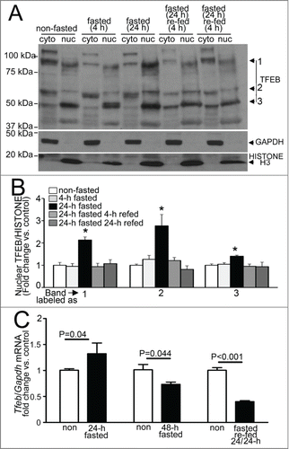 Figure 11. Fasting induces nuclear translocation of TFEB in the myocardium. (A and B) Representative immunoblot (A) with quantification of nuclear TFEB (B, bands numbers from A) in nuclear and cytoplasmic subfractions from wild-type adult male C57BL/6 mouse hearts subjected to indicated durations of fasting and refeeding. Immunoblotting for GAPDH and Histone H3 was employed to detect enrichment of cytoplasmic and nuclear subfractions, respectively. N = 3 /group. P value is by post-hoc analysis after one-way ANOVA. (C) Quantitative PCR analysis of relative abundance of Tfeb transcript in mice subjected to 24 or 48 h of fasting (with age matched nonfasted controls); fasting for 24 h followed by refeeding for 24 h (fasted-refed). N = 4 to 8/group. P value is by t test vs. control. RNA from a common group of nonfasted mice was employed as control to compare transcript abundance in 24- and 48-h fasted samples.